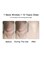 USB Rechargeable 3 Modes Heat High Frequency Face Massager Anti-Aging Neck Eye Massager Vibration Anti Double Chin Wrinkles Facial Device for Skin Tightening and Lift Puffiness