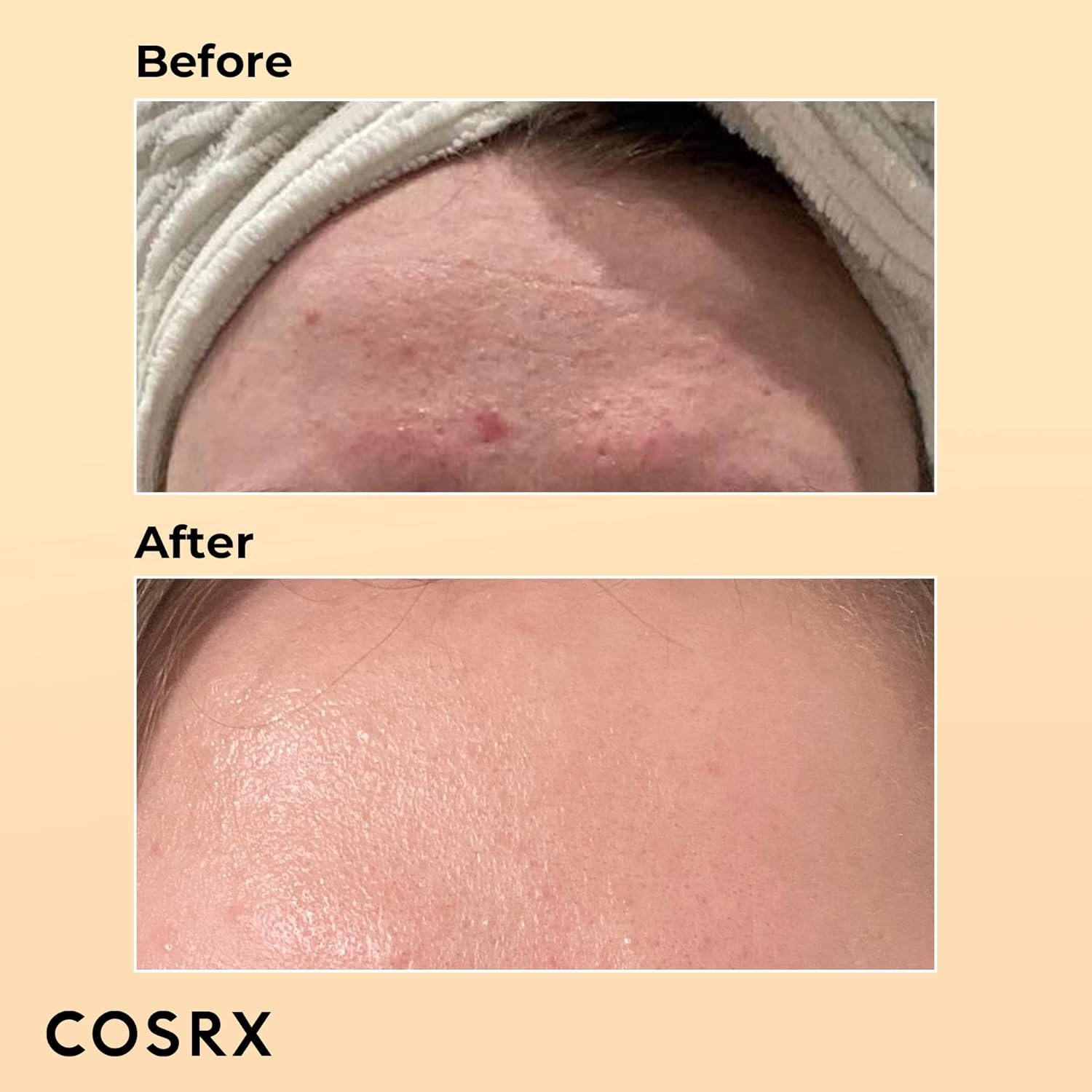 COSRX Skin Cycling Routine - Snail Mucin 96% Essence + Retinol 0.1 Cream, Recovery Set For Face And Neck, Fine Lines Spot Treatment, Repair Cream For Face