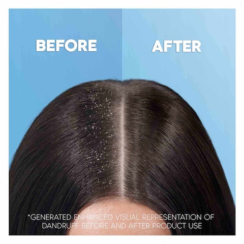 Head And Shoulders Deep Hydration Coconut Oil Anti Dandruff Shampoo 500ml