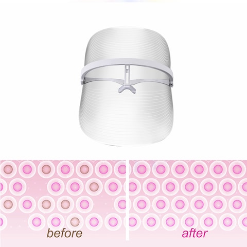 Generic-LED Photonic Skin Instrument 3 Colors Light Skin Care LED Facial Mask Rejuvenation Wrinkle Acne Removal Skin Whitening Masks