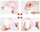 StyloPlus Lint Rollers, Pet Hair Remover, Super Sticky Pet Epilator Kit, Dog &amp; Cat Hair Remove, Pet Hairs Remover form Sofas, Apparels, Bedding, Carpets And Others (with 9 Refills)
