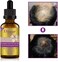 Disaar Beauty Natural Hair Growth Ginger Essential Oil, Anti Hair Loss Essence, Healthy Strong Thick Hair, Treats Baldness Weak Brittle Thinning Hair